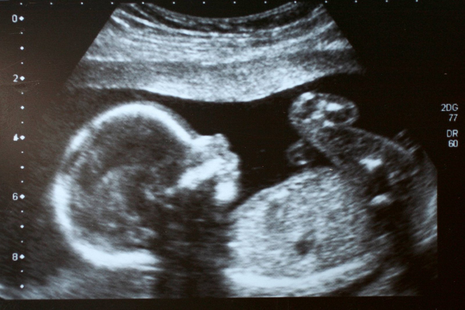 pregnancy help